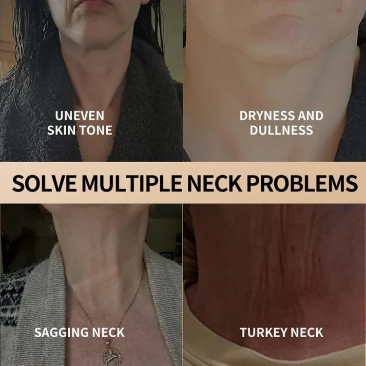 ⭐⭐💧Neck-Eye Care Tightening & Revitalizing Set