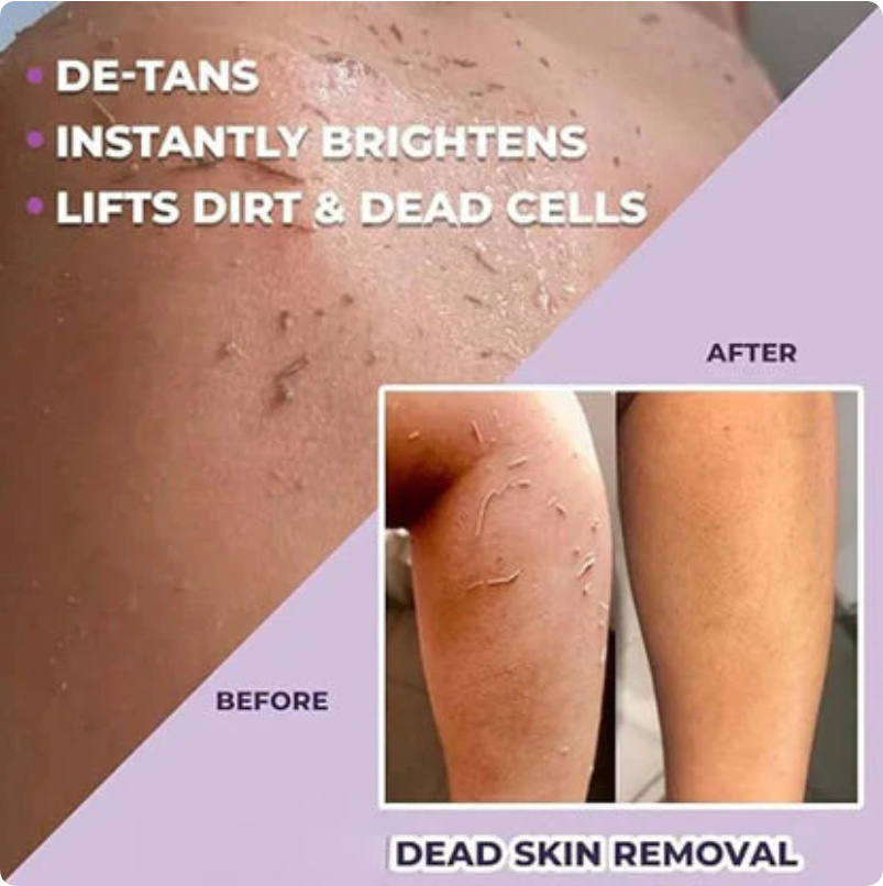 Dead Skin & Tan Remover for Smooth, Radiant Skin 🌞✨ (Buy 1 Get 1 Free🔥)