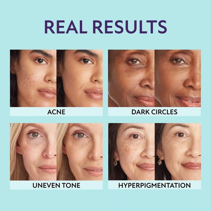 🎁Buy One Get One Free🎁 - All Over Complexion Perfector